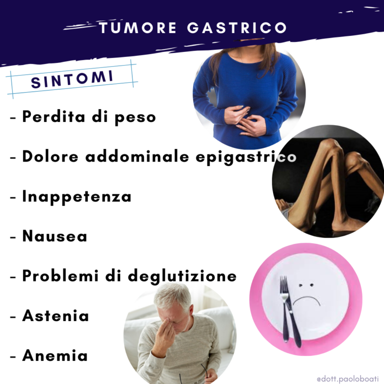 Tumore Dello Stomaco O Neoplasia Gastrica Dott Boati